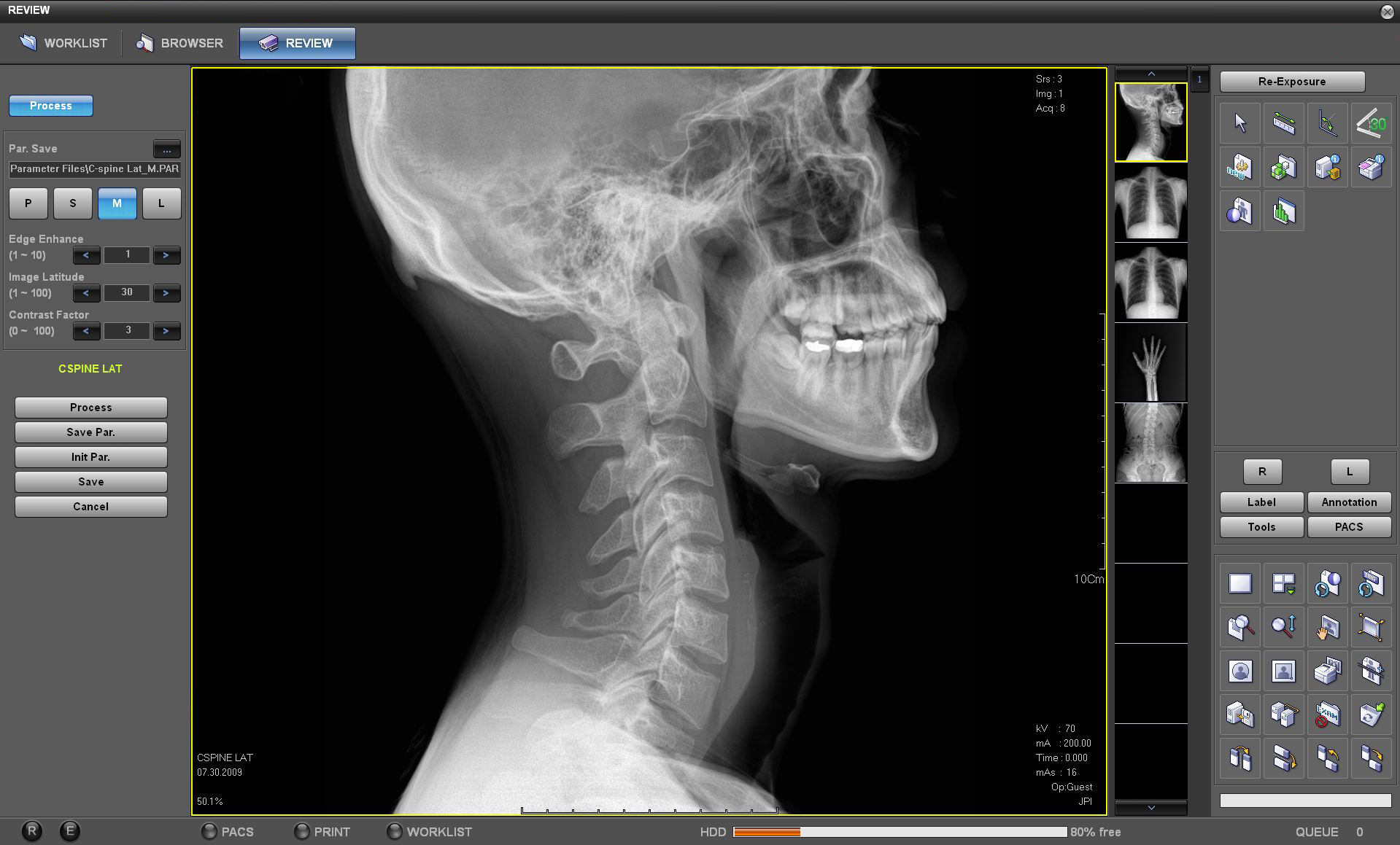 Digital X-Rays are used at Family First Chiropractic in Dripping.