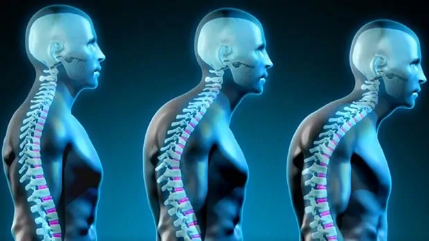 How a Chiropractor Can Help Improve your Posture