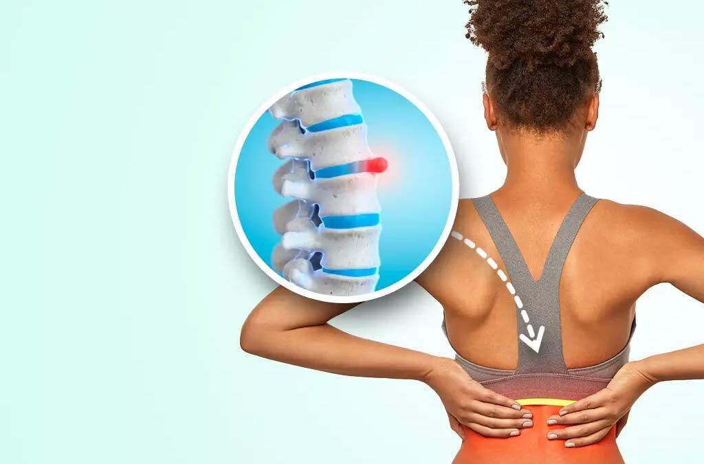 Is There a Non-surgical Option for Bulging Disc Pain Relief in Dripping Springs TX?